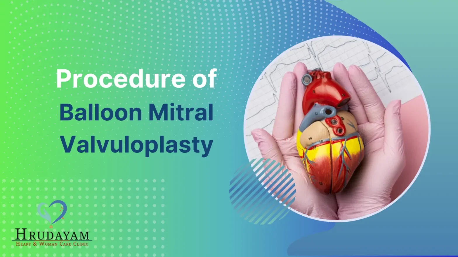 procedure-of-balloon-mitral-valvuloplasty